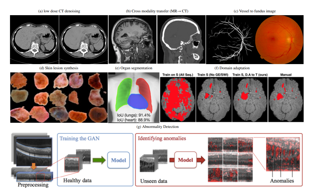 GANs in Medical Imaging